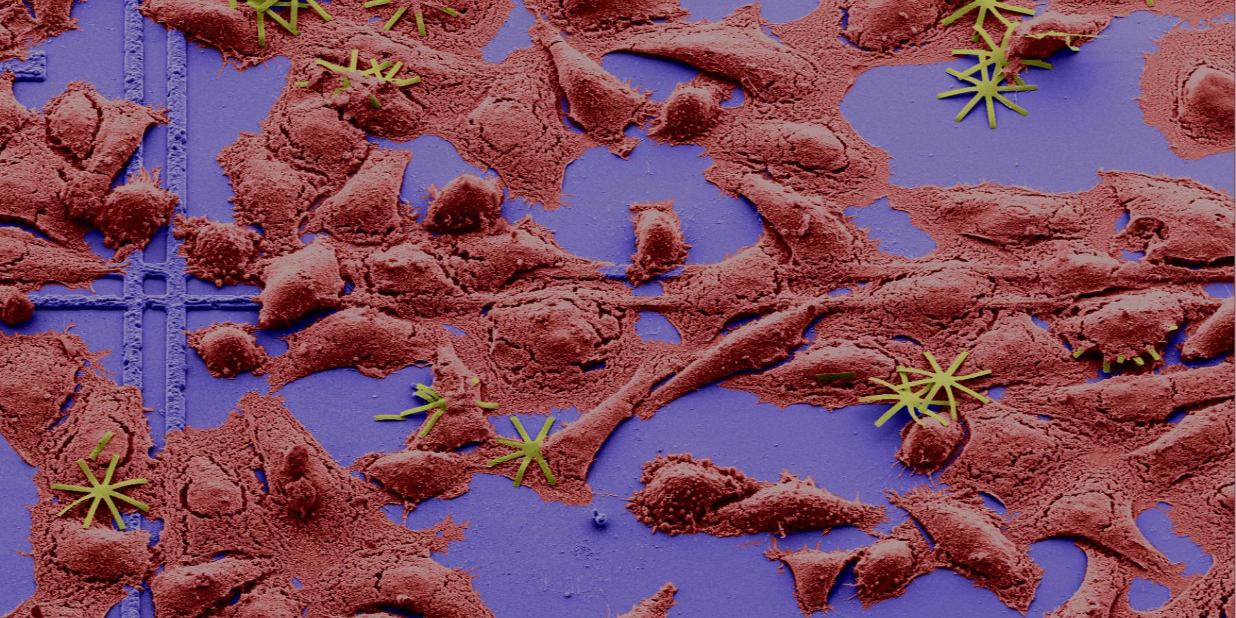 Ejercito de chips de silicio en forma de estrella sobre una población de células HeLa | CSIC.